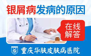 牛皮癣是怎么引起的